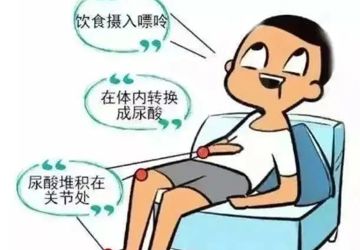 莫让痛风变“痛疯”