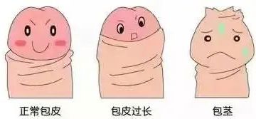暑假要不要带孩子割包皮？纠结的家长们看这里