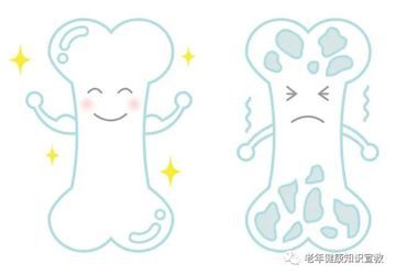 【创建老年友善医院】骨质疏松那些谣言，你信了吗