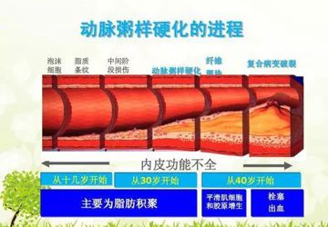 什么是冠心病？突发胸痛怎么办？
