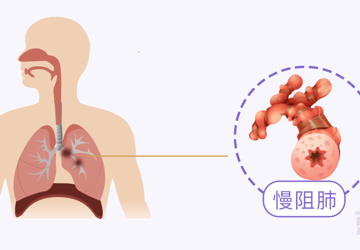这个比肺癌还歪的病，是个啥来头？华西医生带你戳穿它